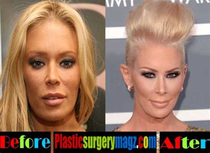 Jenna Jameson Before and After Plastic Surgery — See the Former Porn Star’s Drastic Transformation!